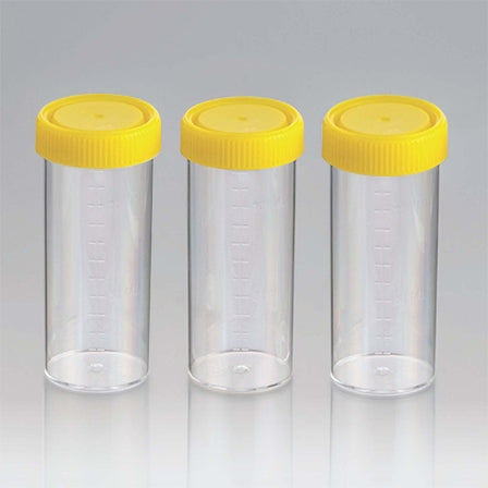 Techno Plas Container Specimen 120ml yellow Cap GS – Pacific Laboratory ...